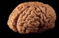 /album/galeria-de-fotos-imagens/brain4-jpg/