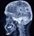 /album/galeria-de-fotos-imagens/cerebro-do-cretino-jpg/