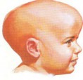 /album/diversas/cria-hidrocef-jpg/