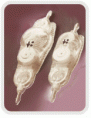 /album/diversas/hidrocefalia-valvula-programavel1-gif/