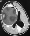 /album/neuroimagem/a2053070165-131b90dacd-jpg/