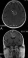 /album/neuroimagem/getimage-cgi-jpg/