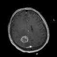 /album/neuroimagem/images-jpg/