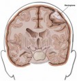/album/diversas/meningioma-33163137-std-jpg/